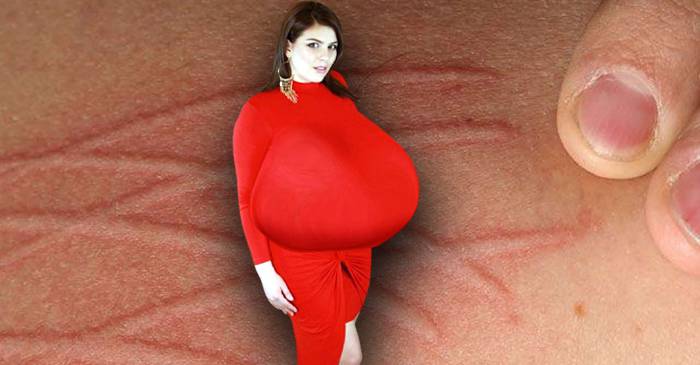 10 boli rare și foarte ciudate și simptomele lor neobișnuite