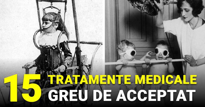 15 tratamente medicale greu de acceptat_compressed