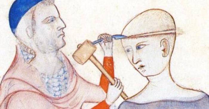 Istoria medicinei - 5 tratamente periculoase, care grăbeau moartea pacienților FEATURED_compressed