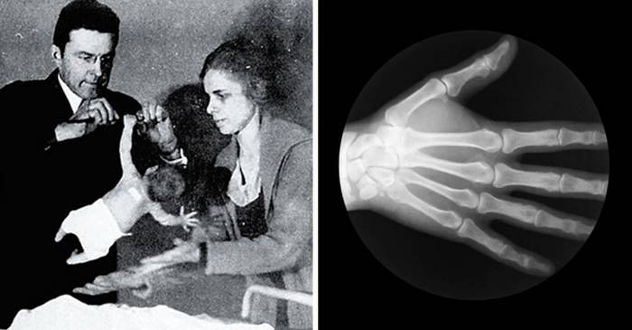 10 curiozități despre corpul uman, cel mai misterios sistem din lume featured_compressed