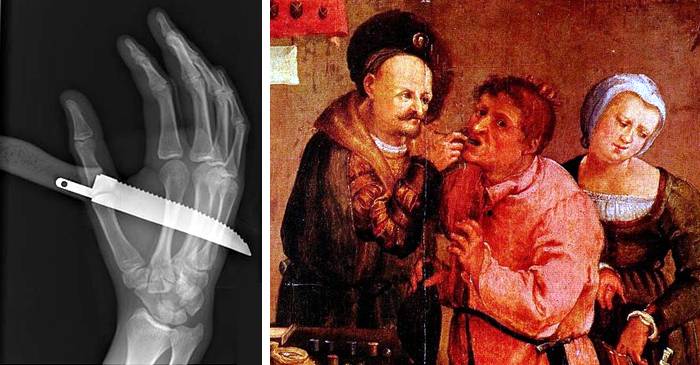 7 descoperiri medicale revoluționare, care au salvat milioane de vieți FEATURED_compressed