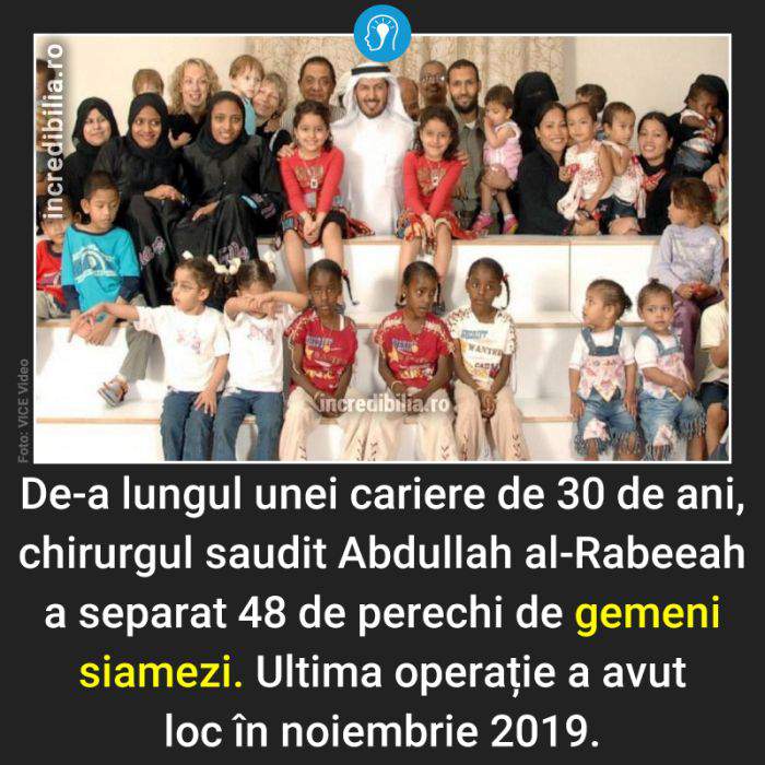 438. chirurg saudit gemeni siamezi_38_red