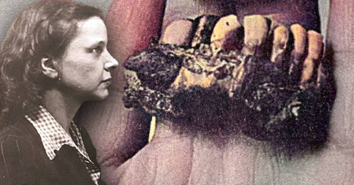 Coșmarul lui Käthe Heusermann, femeia care a identificat cadavrul lui Hitler