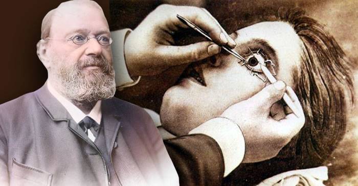 Wilhelm Kühne, savantul care a extras imagini de pe retina unui criminal decapitat
