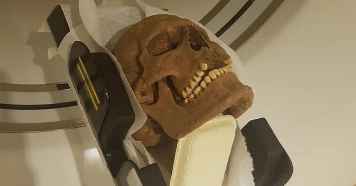 Ce dezvăluie tomografiile despre sănătatea vikingilor suedezi?